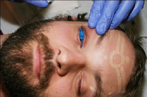  to say to this image gallery detailing the world's first eyeball tattoo.